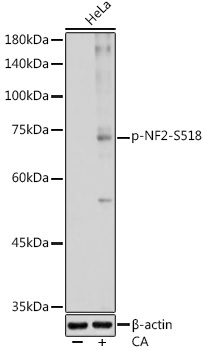 Phospho-NF2-S518 Rabbit Polyclonal Antibody