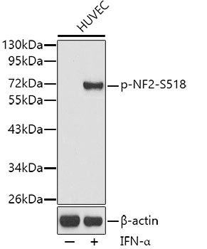 Phospho-NF2-S518 Rabbit Polyclonal Antibody