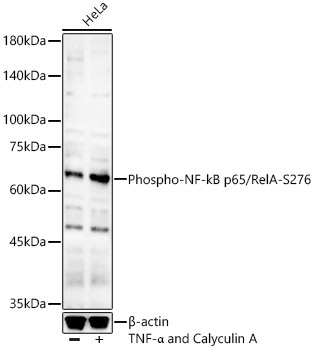 Phospho-NF-kB p65/RelA-S276 Rabbit Polyclonal Antibody