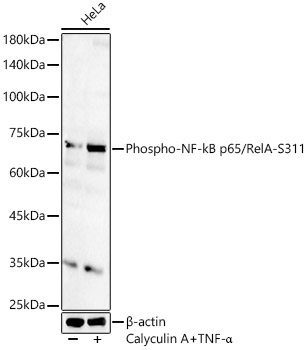 Phospho-NF-kB p65/RelA-S311 Rabbit Polyclonal Antibody