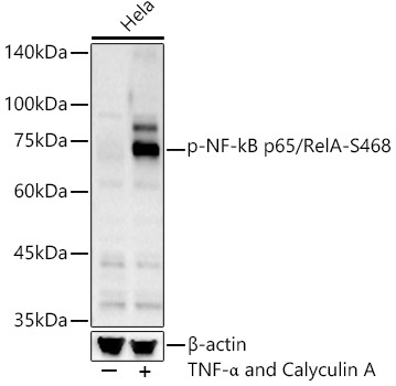 Phospho-NF-kB p65/RelA-S468 Rabbit Polyclonal Antibody