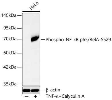 Phospho-NF-kB p65/RelA-S529 Rabbit Monoclonal Antibody