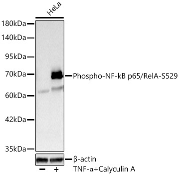 Phospho-NF-kB p65/RelA-S529 Rabbit Polyclonal Antibody