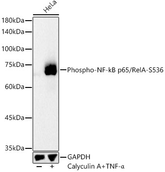 Phospho-NF-kB p65/RelA-S536 Rabbit Polyclonal Antibody