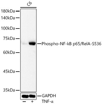 Phospho-NF-kB p65/RelA-S536 Rabbit Polyclonal Antibody - Image 3