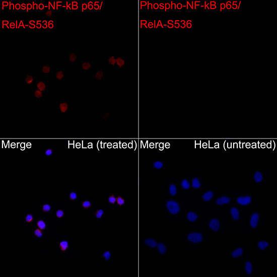 Phospho-NF-kB p65/RelA-S536 Rabbit Polyclonal Antibody - Image 4
