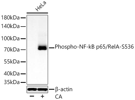 Phospho-NF-kB p65/RelA-S536 Rabbit Polyclonal Antibody