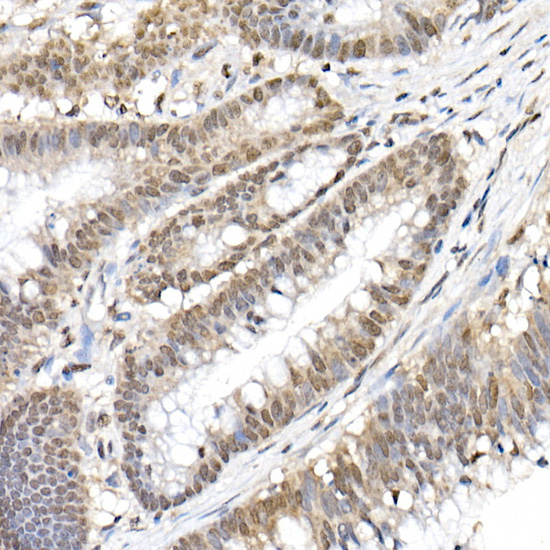 Phospho-NF-kB p65/RelA-S536 Rabbit Polyclonal Antibody - Image 2