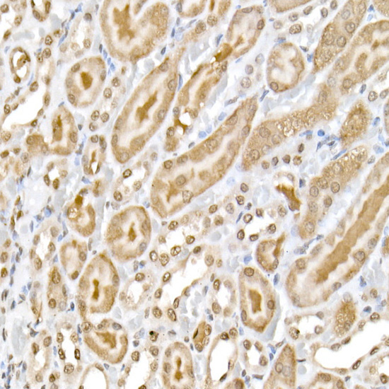 Phospho-NF-kB p65/RelA-S536 Rabbit Polyclonal Antibody - Image 3