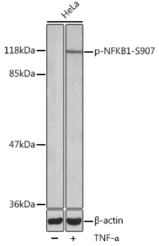Phospho-NFKB1-S907 Rabbit Polyclonal Antibody