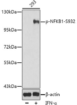 Phospho-NFKB1-S932 Rabbit Polyclonal Antibody