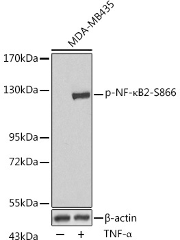 Phospho-NF-?B2-S866 Rabbit Polyclonal Antibody