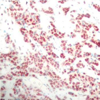 Phospho-NF-?B2-S866 Rabbit Polyclonal Antibody - Image 2
