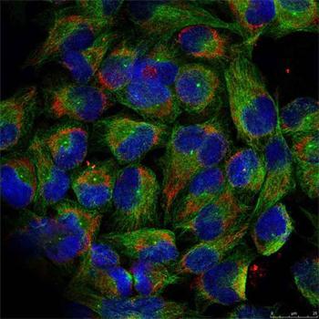 Phospho-NF-?B2-S866 Rabbit Polyclonal Antibody - Image 3