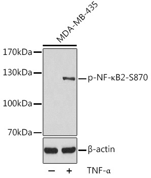 Phospho-NF-?B2-S870 Rabbit Polyclonal Antibody