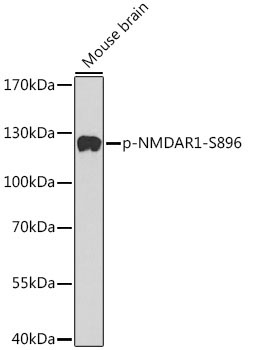 Phospho-NMDAR1-S896 Rabbit Polyclonal Antibody