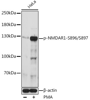 Phospho-NMDAR1-S896/S897 Rabbit Polyclonal Antibody