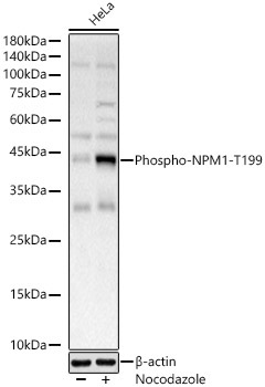 Phospho-NPM1-T199 Rabbit Polyclonal Antibody