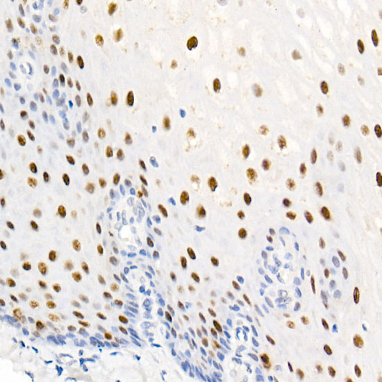 Phospho-Nucleolin-T76 Rabbit Monoclonal Antibody