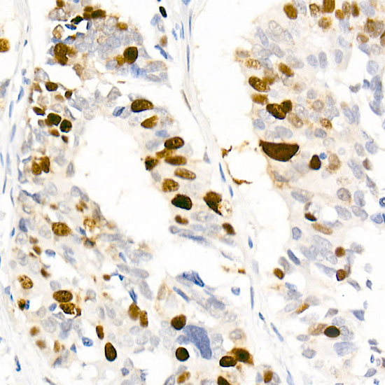 Phospho-Nucleolin-T76 Rabbit Monoclonal Antibody - Image 2