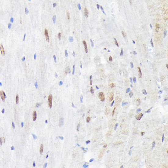 Phospho-p38 MAPK-T180 Rabbit Polyclonal Antibody - Image 3
