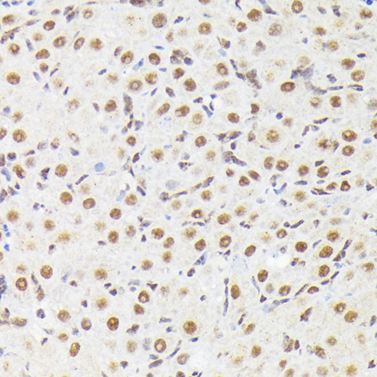 Phospho-p38 MAPK-T180 Rabbit Polyclonal Antibody - Image 4