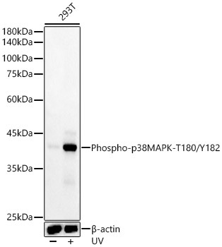 Phospho-p38 MAPK-T180/Y182 Rabbit Monoclonal Antibody