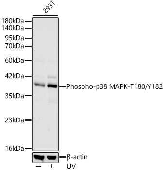 Phospho-p38 MAPK-T180/Y182 Rabbit Monoclonal Antibody