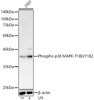 Phospho-p38 MAPK-T180/Y182 Rabbit Polyclonal Antibody