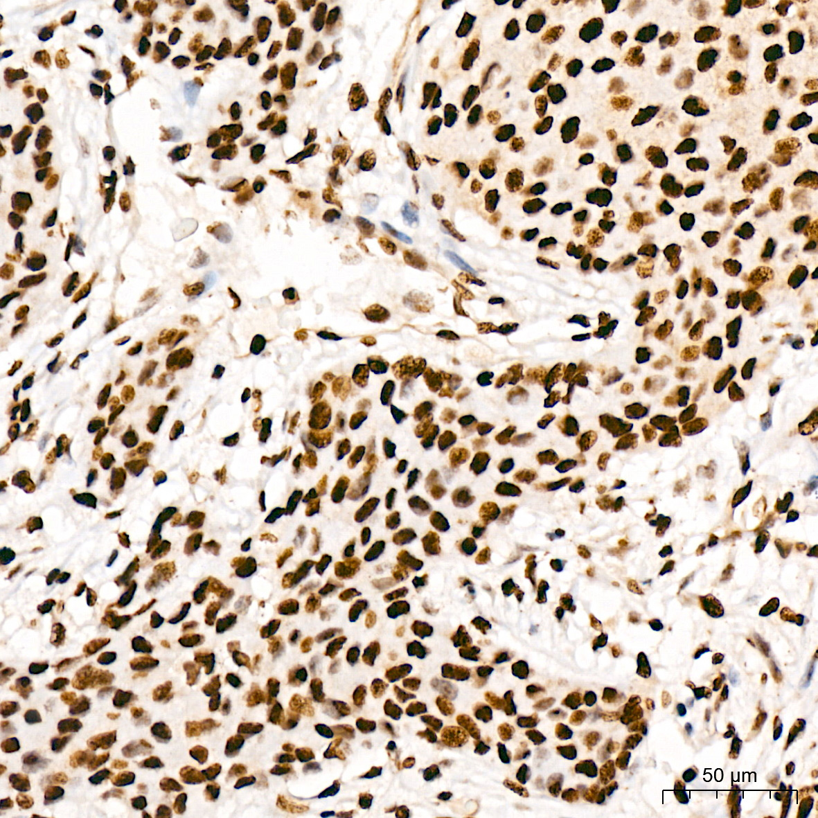 Phospho-p38 MAPK-T180/Y182 Rabbit Polyclonal Antibody - Image 3