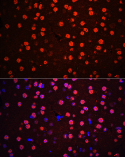 Phospho-p38 MAPK-T180/Y182 Rabbit Polyclonal Antibody - Image 7