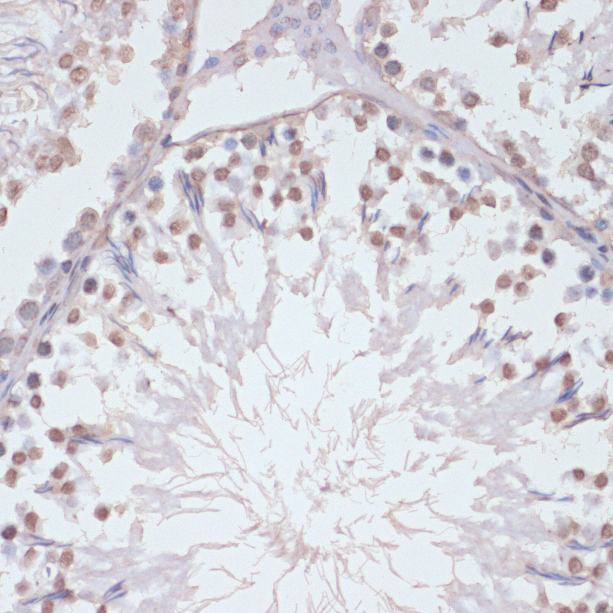 Phospho-p38 MAPK-T180/Y182 Rabbit Polyclonal Antibody