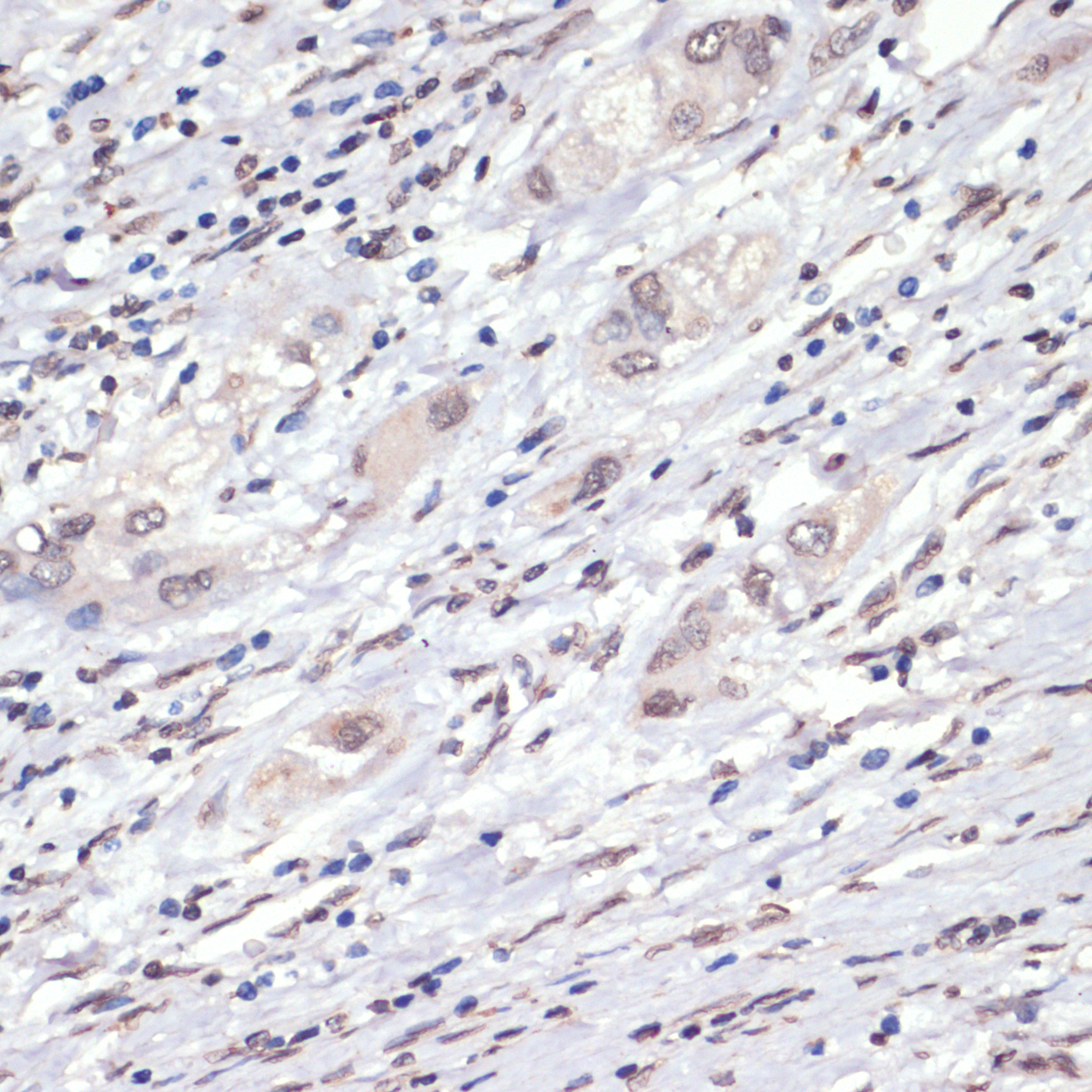 Phospho-p38 MAPK-T180/Y182 Rabbit Polyclonal Antibody - Image 2