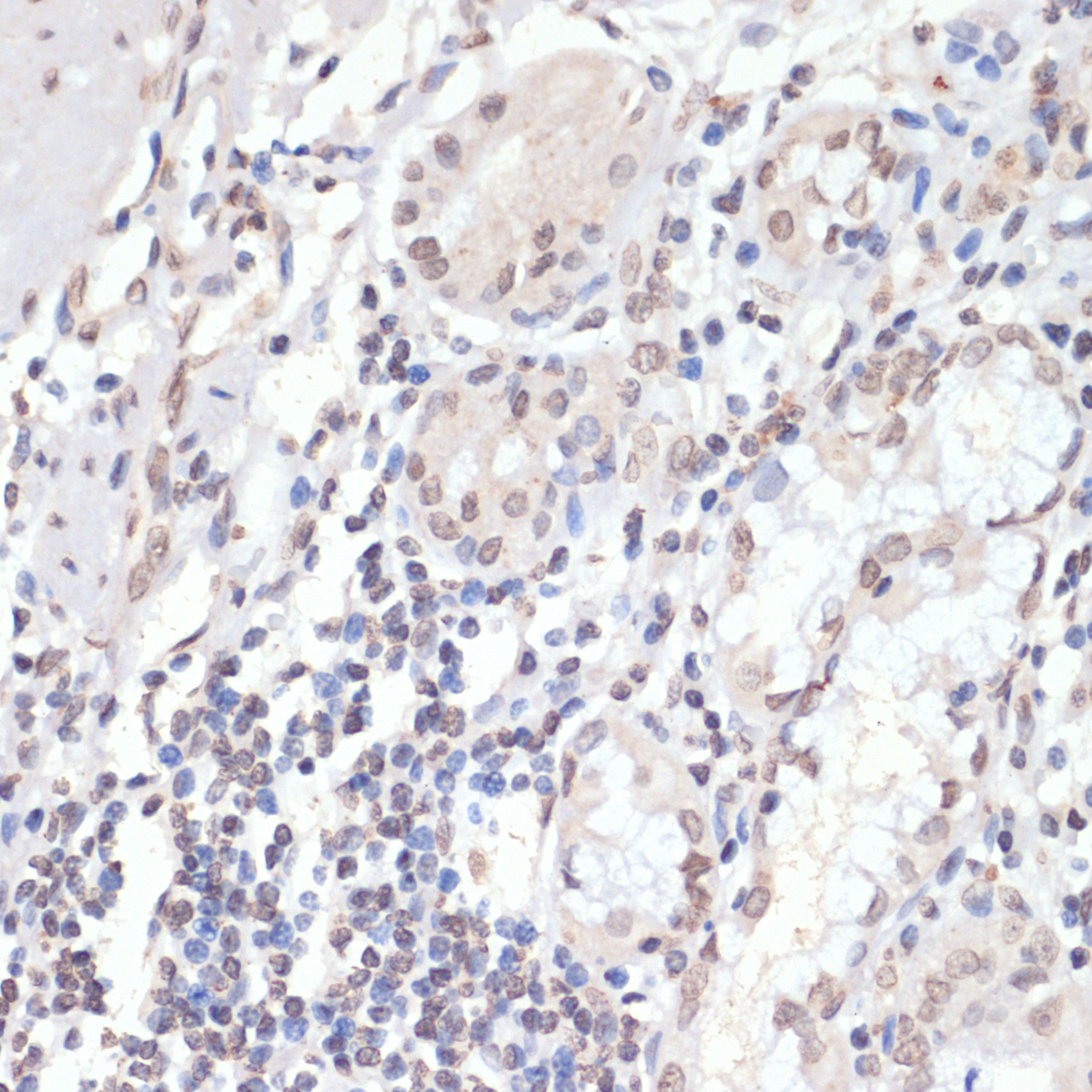 Phospho-p38 MAPK-T180/Y182 Rabbit Polyclonal Antibody - Image 3