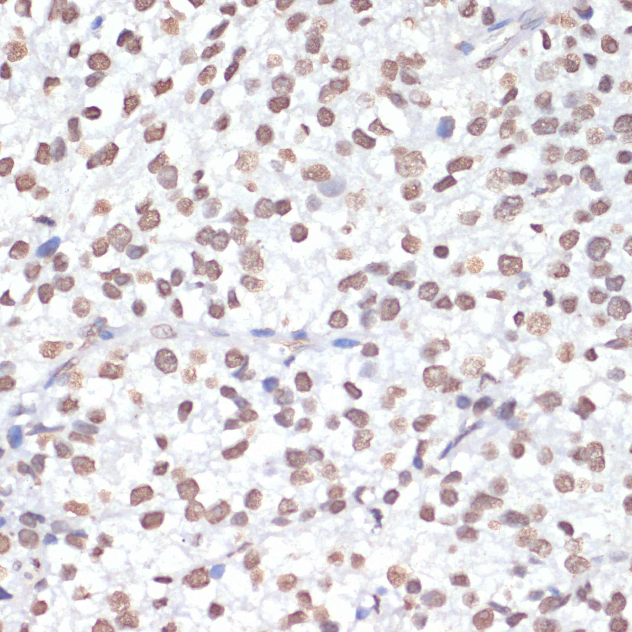 Phospho-p38 MAPK-T180/Y182 Rabbit Polyclonal Antibody - Image 4