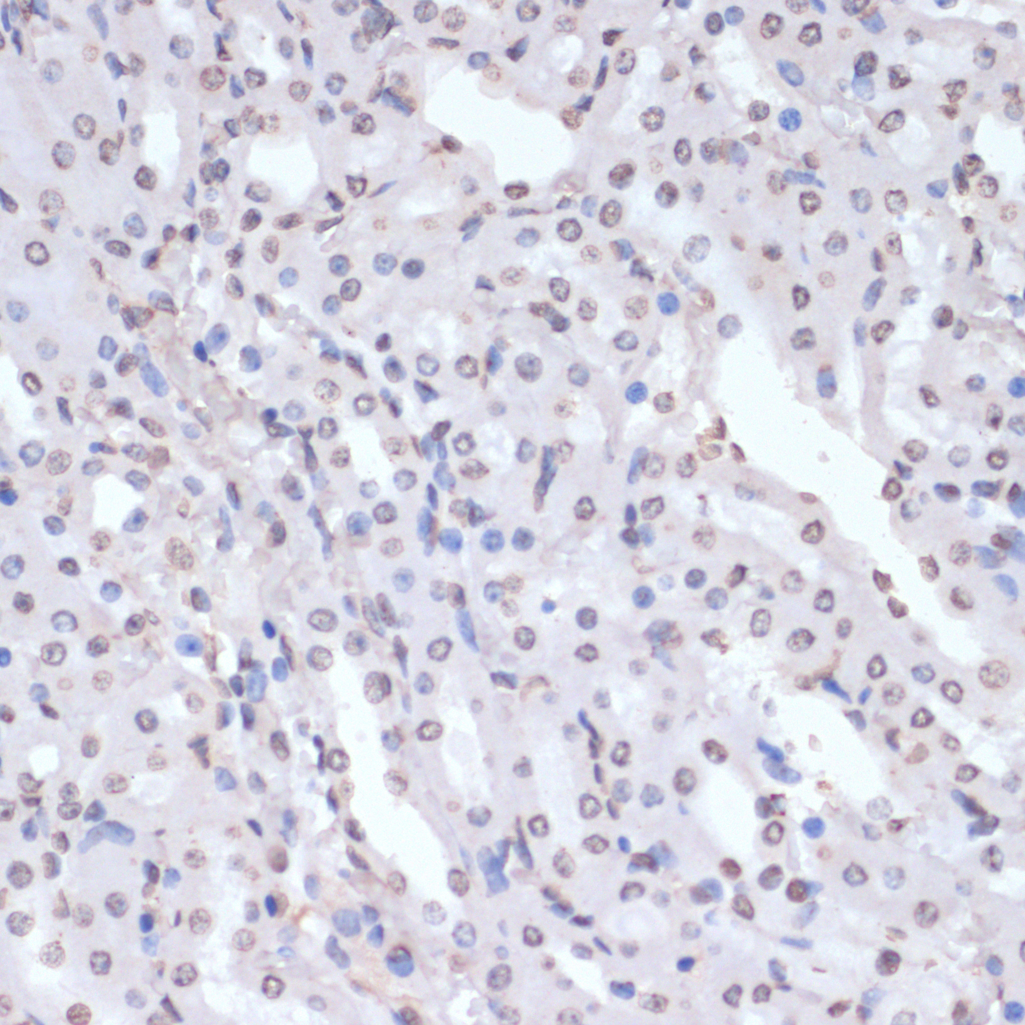 Phospho-p38 MAPK-T180/Y182 Rabbit Polyclonal Antibody - Image 5