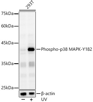 Phospho-p38 MAPK-Y182 Rabbit Polyclonal Antibody
