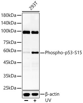 Phospho-p53-S15 Rabbit Polyclonal Antibody