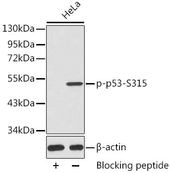 Phospho-p53-S315 Rabbit Polyclonal Antibody