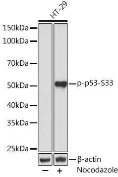 Phospho-p53-S33 Rabbit Monoclonal Antibody
