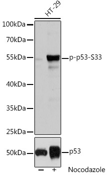 Phospho-p53-S33 Rabbit Polyclonal Antibody