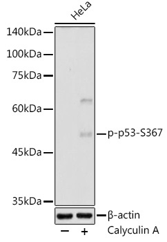 Phospho-p53-S367 Rabbit Polyclonal Antibody