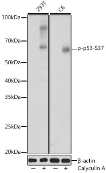 Phospho-p53-S37 Rabbit Polyclonal Antibody