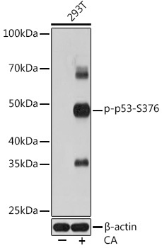 Phospho-p53-S376 Rabbit Monoclonal Antibody