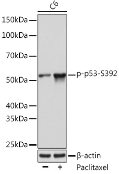 Phospho-p53-S392 Rabbit Monoclonal Antibody