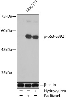 Phospho-p53-S392 Rabbit Polyclonal Antibody