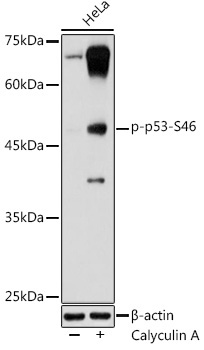 Phospho-p53-S46 Rabbit Polyclonal Antibody