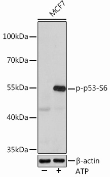 Phospho-p53-S6 Rabbit Polyclonal Antibody