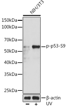 Phospho-p53-S9 Rabbit Monoclonal Antibody