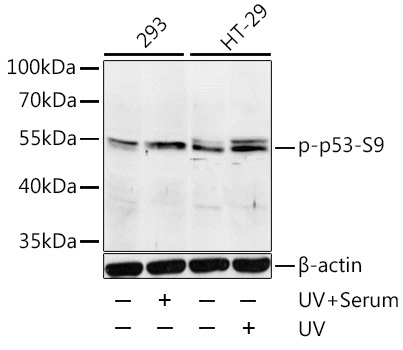 Phospho-p53-S9 Rabbit Polyclonal Antibody